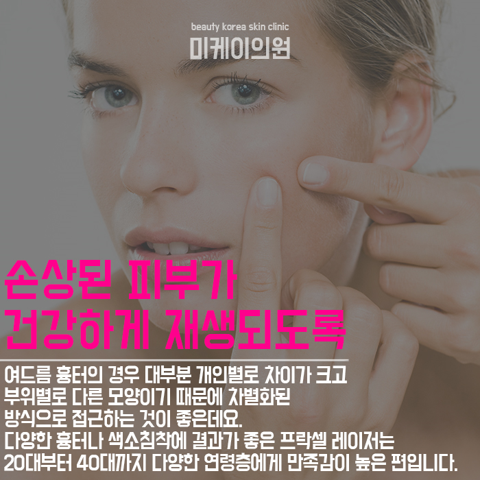 서초프락셀레이저 다양한 연령층에게 결과가 좋은 프로그램 관련 이미지 4