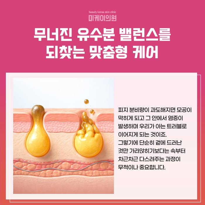 The Start of Acne Skin Care in Seocho image 2