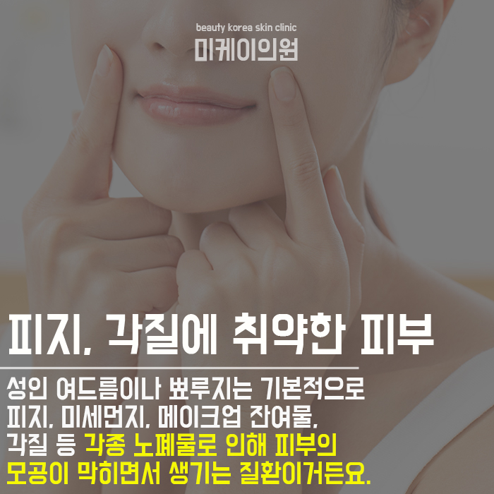 마스크뾰루지 원인과 예방 방법 정리해봤어요 관련 이미지 3