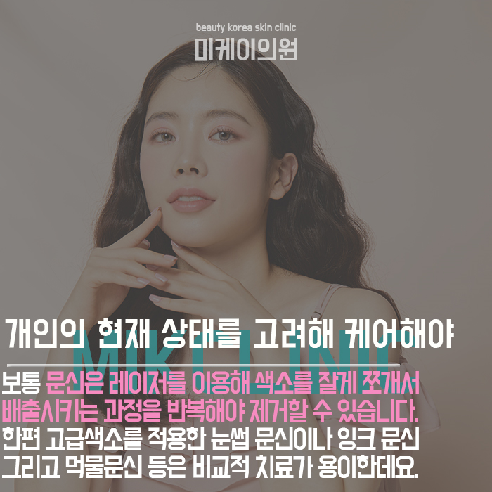 문신제거주의사항 흉터를 최소화하고 깨끗하게 지워요. 관련 이미지 3