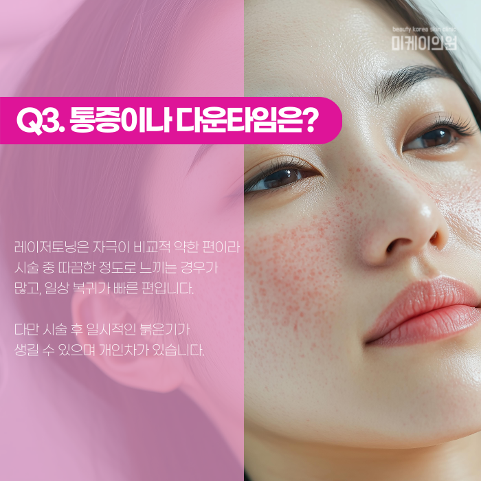 강남 레이저토닝, 한 번에 안 없어지는 이유는? 관련 이미지 4