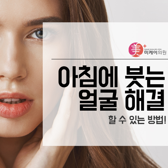 아침에 붓는 얼굴 해결 할 수 있는 방법! 관련 이미지 1