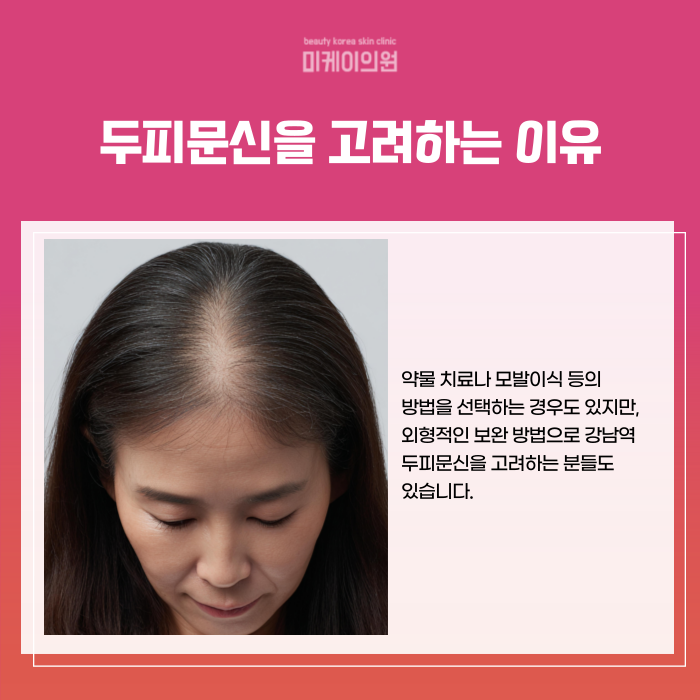 Gangnam Station Scalp Micropigmentation: How to Naturally Cover Thinning Hair image 3