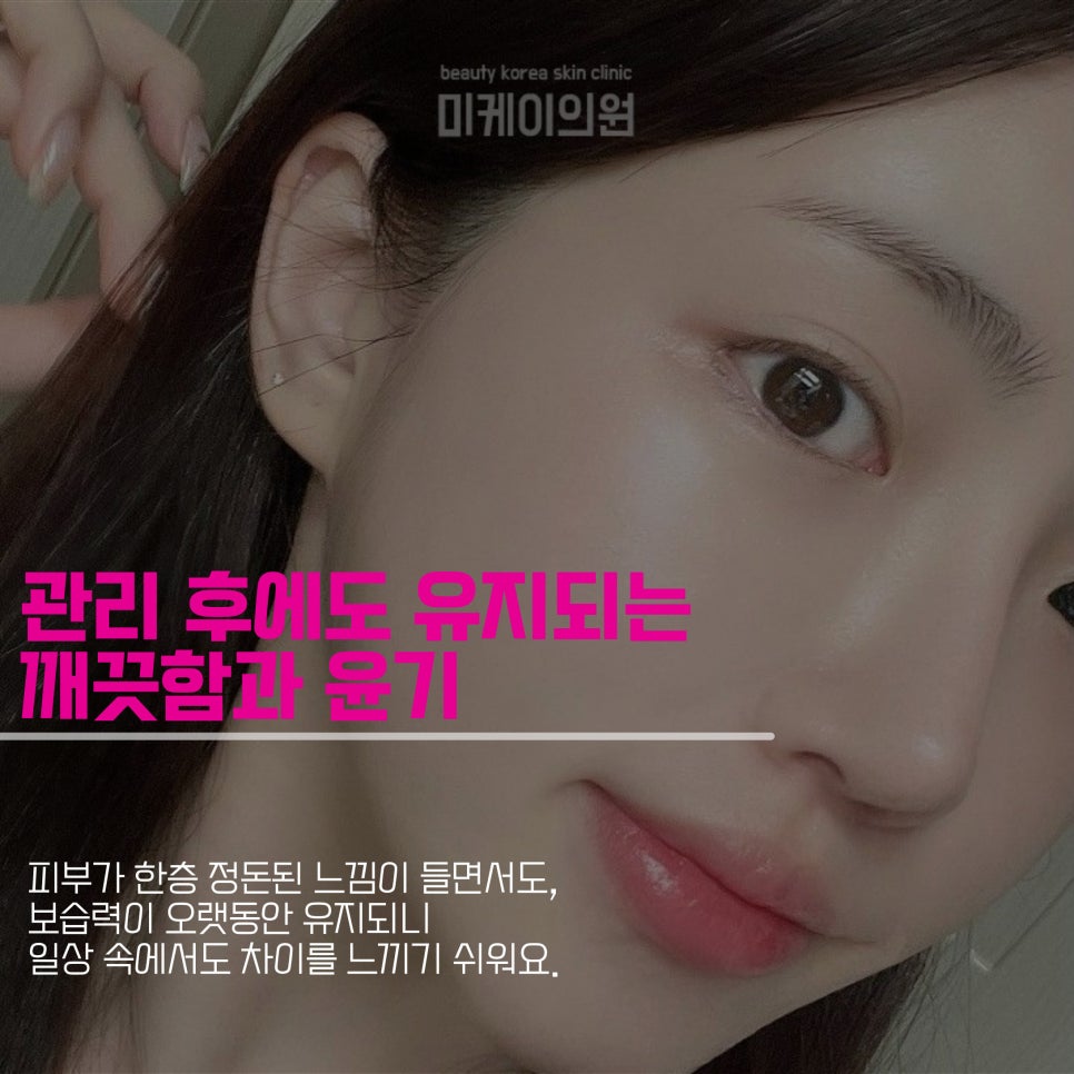Clear and Transparent Skin with Aqua Peel at Gangnam Station image 5