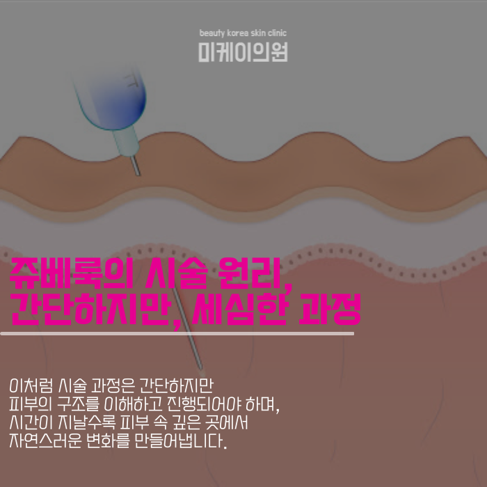 강남역피부관리, 쥬베룩의 매력 관련 이미지 2