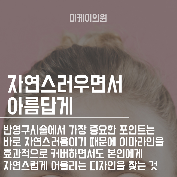 헤어라인반영구 하기 전 주의사항 관련 이미지 4