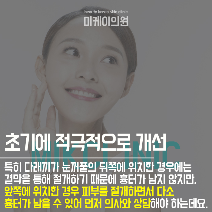 눈두덩이빨갛게되는이유 개인에 따라 달라요 관련 이미지 4