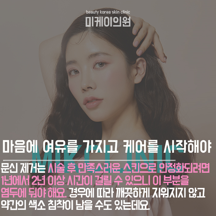 문신제거주의사항 흉터를 최소화하고 깨끗하게 지워요. 관련 이미지 4