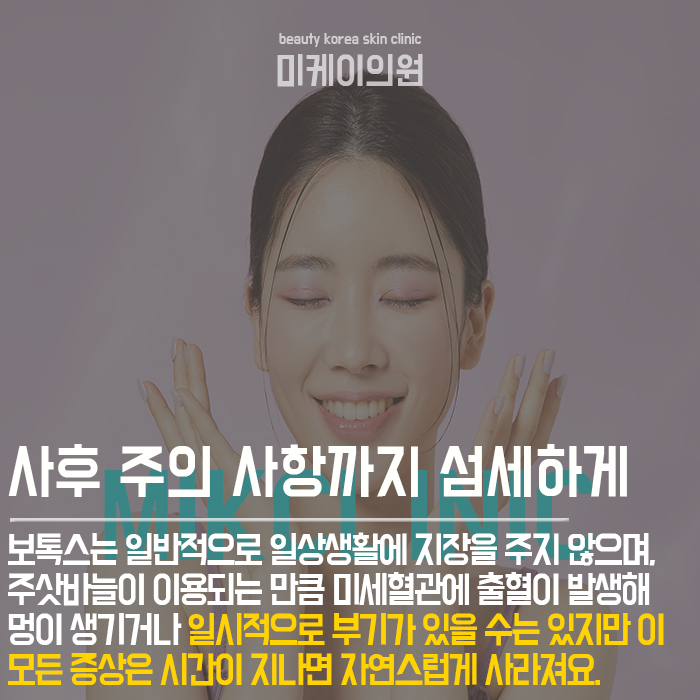 강남보톡스잘하는곳 상담 거쳐 바람직한 결과를 관련 이미지 4