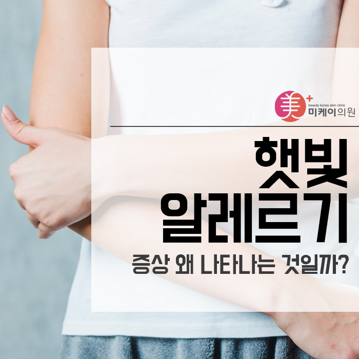 햇빛 알레르기 증상 왜 나타나는 것일까? 관련 이미지 1