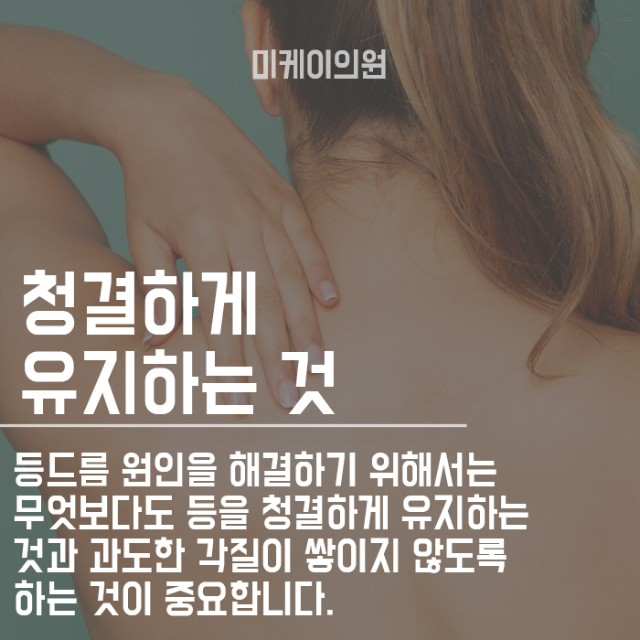 등드름 원인 안 보이는 곳도 중요하다 관련 이미지 6