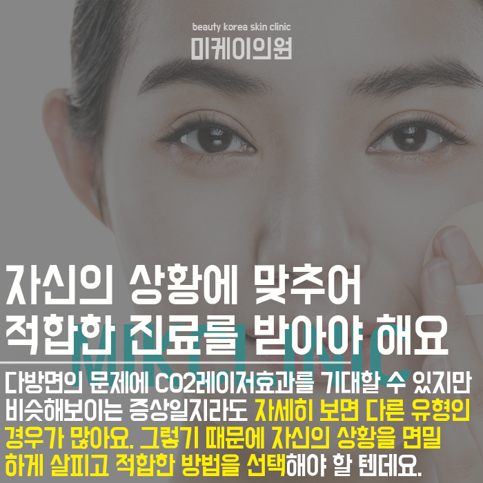 CO2레이저효과 매끈한 피부결 완성 관련 이미지 5