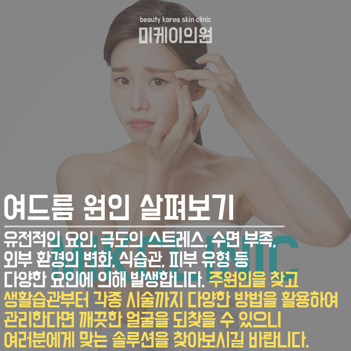 여드름압출관리방법 이것만큼은 꼭 지키세요! 관련 이미지 2