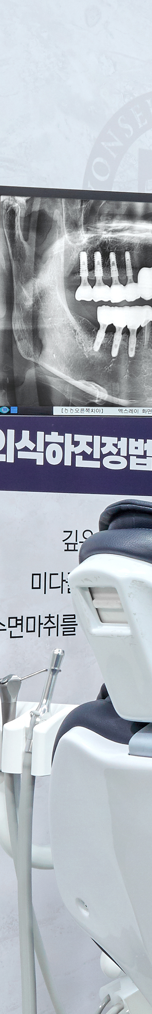 Hapjeong Station Dental Clinic Implant Treatment Through an Appropriate Treatment Plan image 30