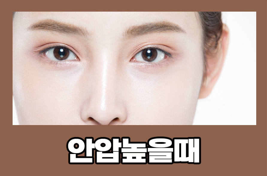 안압높을때 증상과 관리 방법에 대해서 관련 이미지 1