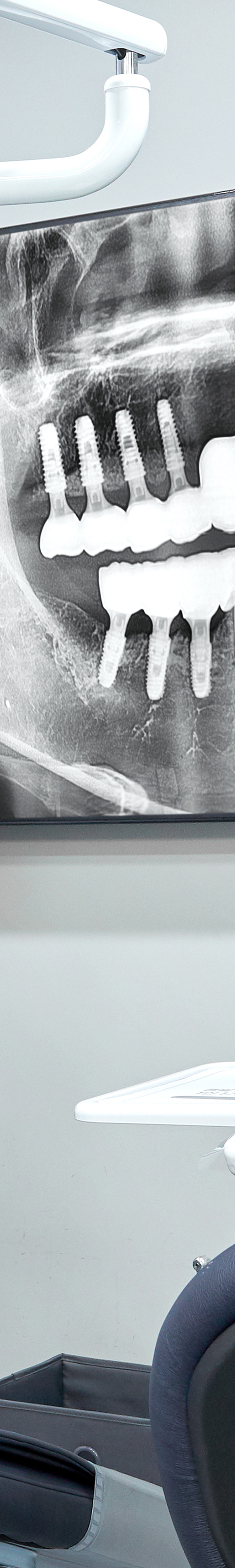Dangsan-dong Dental Clinic: Thorough Implant Care with a Warranty Certificate image 33