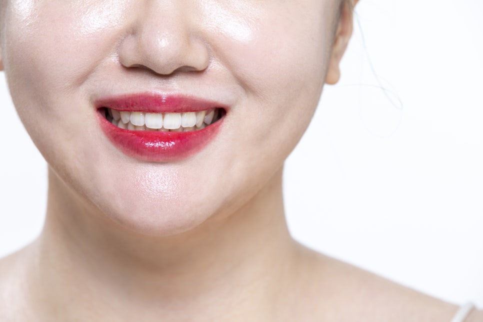 이빨간지러움 잇몸 질환, 충치의 전조증상인지 관련 이미지 5