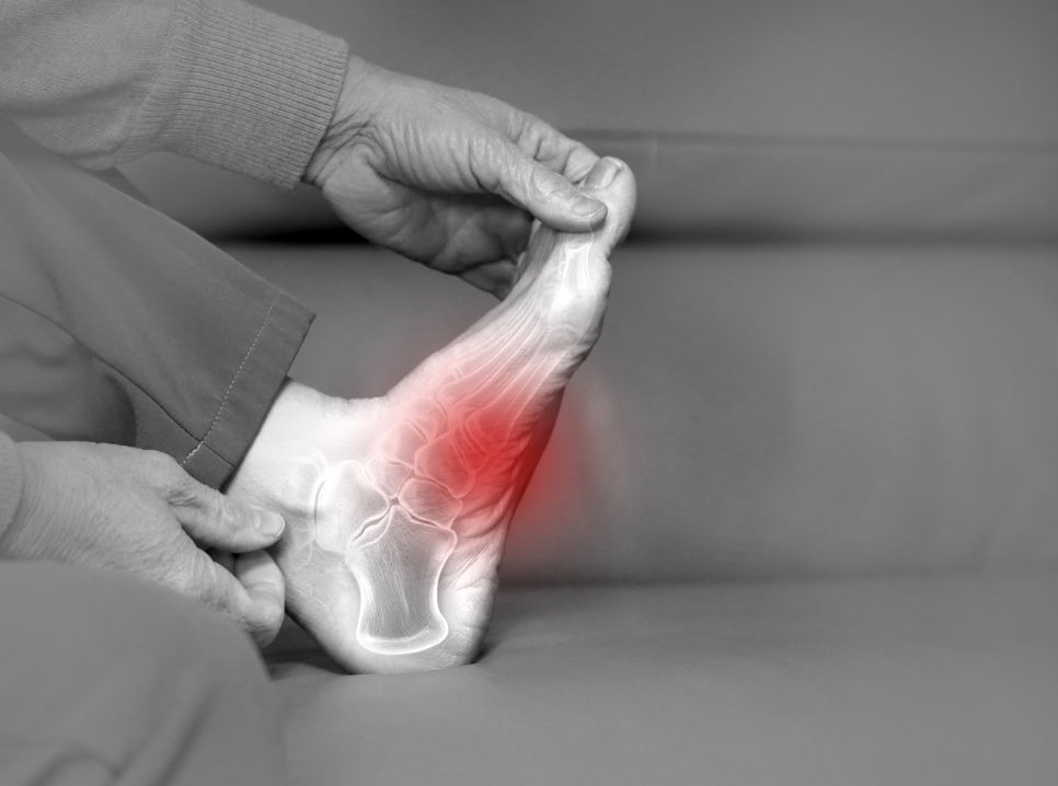 Morton's Neuroma in the Sole of the Foot: Causes, Symptoms, and Treatment for a Complete Cure image 4