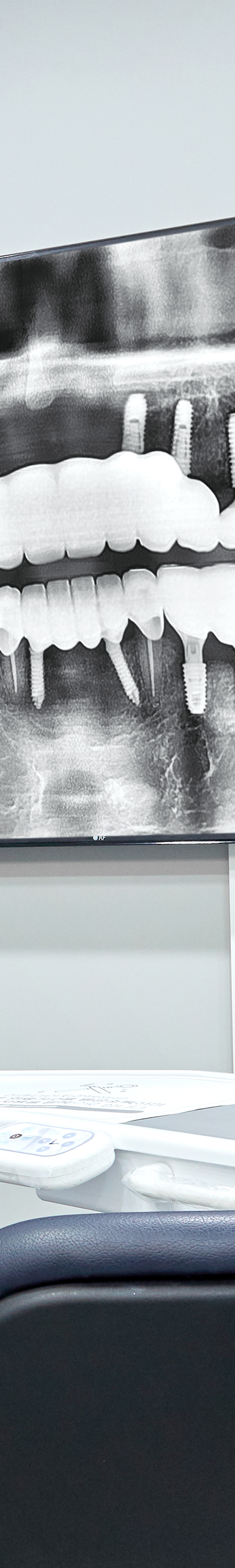 Shinchon Dental Clinic Implant Care Through a Careful Process image 24