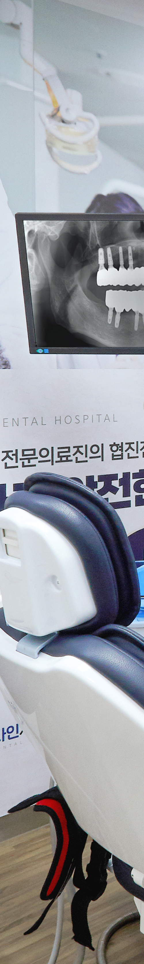 Daesang-dong Dental Clinic Implant Placement: Treatment Through a Careful Process image 36