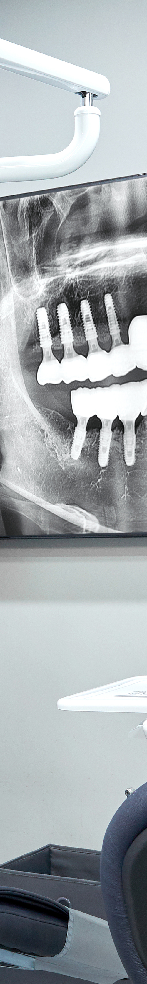Dangsandong Dental Clinic Implant Care Through a Careful Process image 29