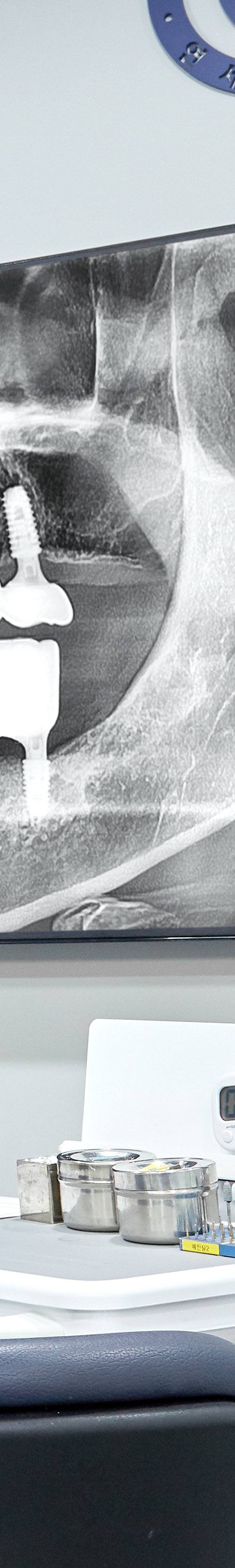 Dangsan Station Dental Clinic: Comfortable Sleep Implant Using Conscious Sedation image 26