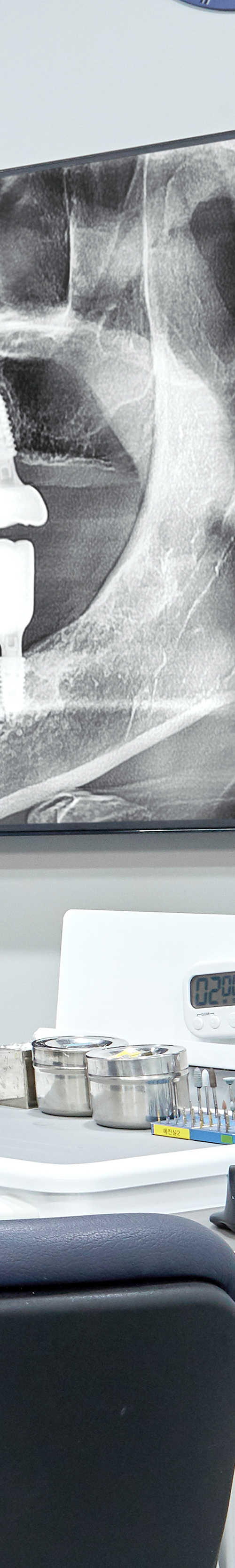 Treatment That Reduces Burden Through Conscious Sedation for Sinchon Dental Implants image 35