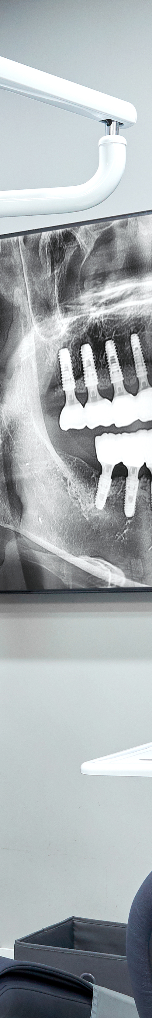 Shinchon Dental Implant Placement and Careful Aftercare image 39