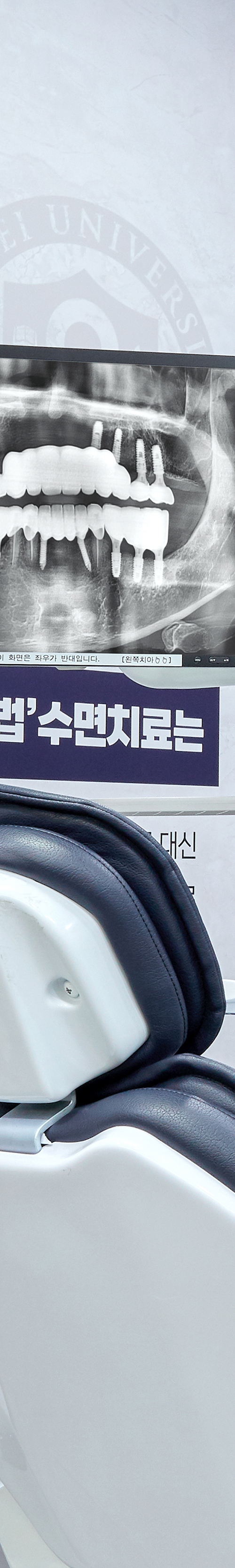 신도림역치과 임플란트식립 면밀한 검진을 통해 관련 이미지 39