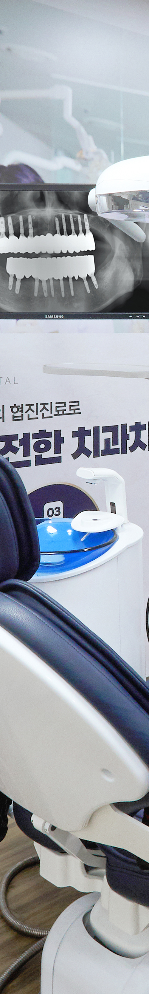 합정역치과 임플란트치료 정밀한 검사를 바탕으로 관련 이미지 30