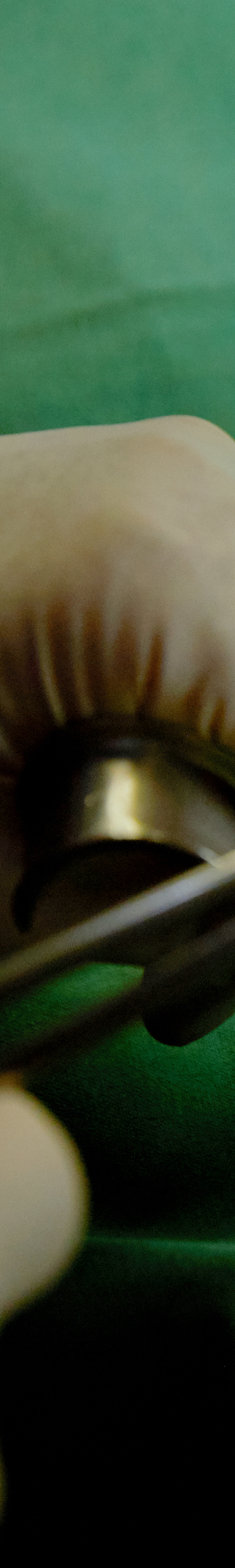 Dangsan Dental Clinic Implant Treatment in a Comfortable State image 24