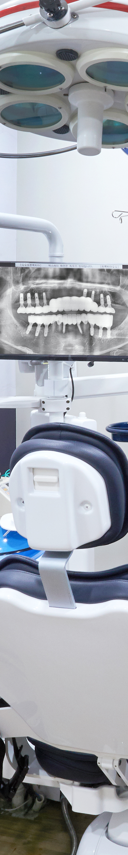 Sinchon Dental Clinic Implant Treatment Period Depending on the Situation image 30