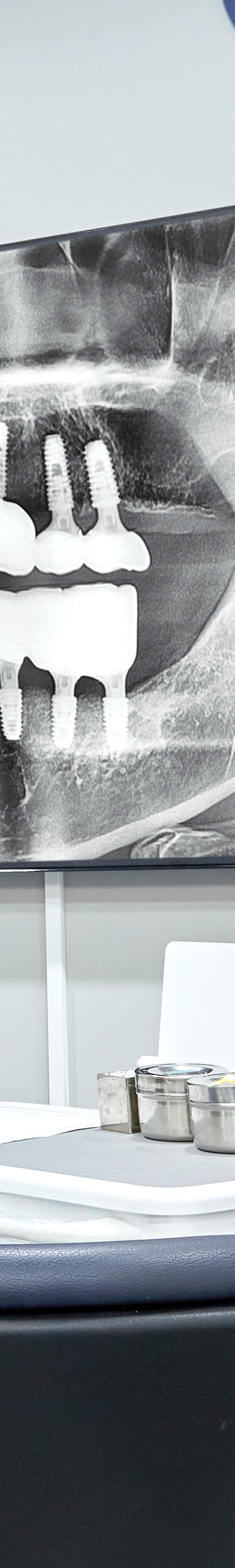 Shinchon Dental Implant Procedure Through an Individualized Plan image 35