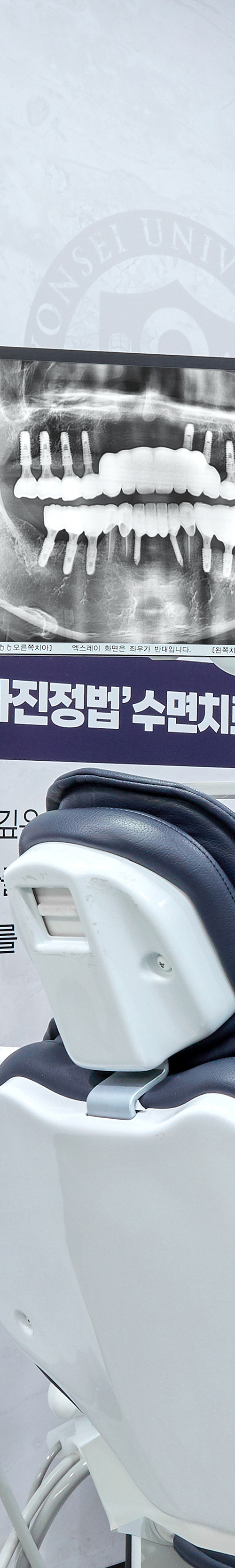 Yeouido Dental Clinic: Implant Treatment Period Depends on the Patient's Condition image 19