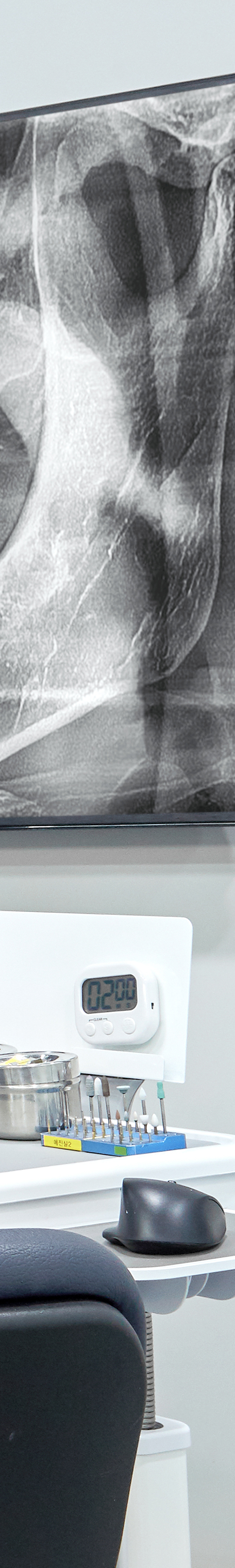 Mangwon-dong Dental Clinic: Comfortable Implant Procedures Through Conscious Sedation image 32