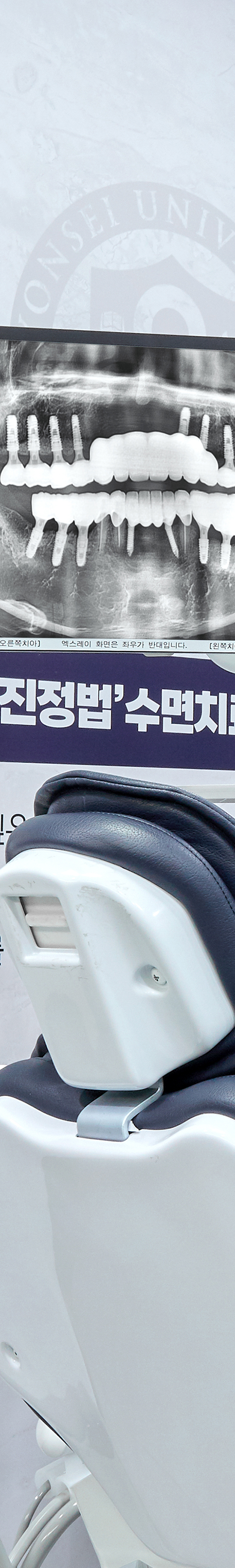 홍대치과 의식하진정법 이용한 수면임플란트 관련 이미지 39