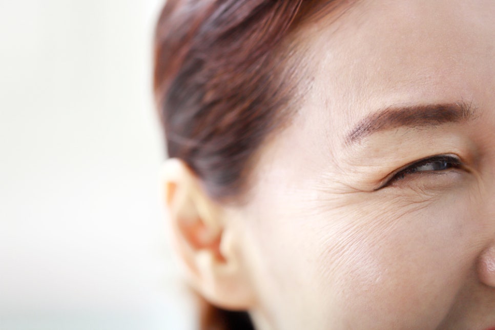 Causes, Symptoms, and Prevention of Red Eyes image 4