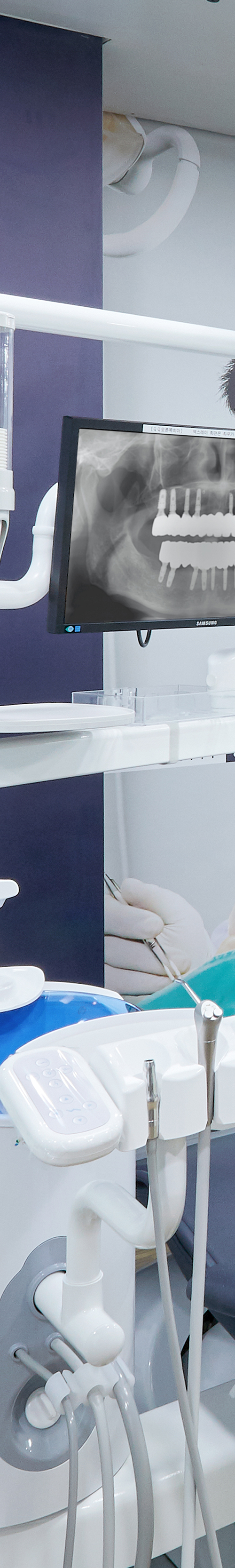 Yeouido Dental Clinic: Implant Treatment Period Depends on the Patient's Condition image 34