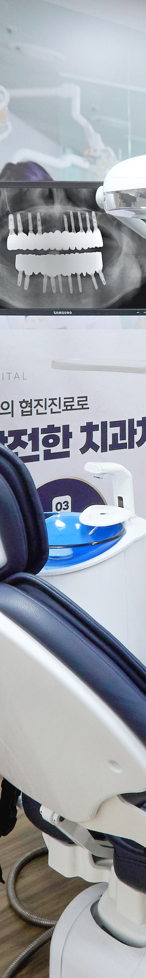 문래역치과 임플란트시술 부작용이 발생되지 않도록 관련 이미지 20