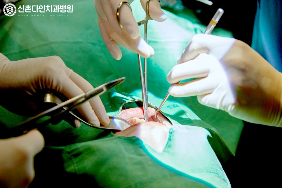 상수동치과 의식하진정법 안정성 높은 수면치료를 관련 이미지 11