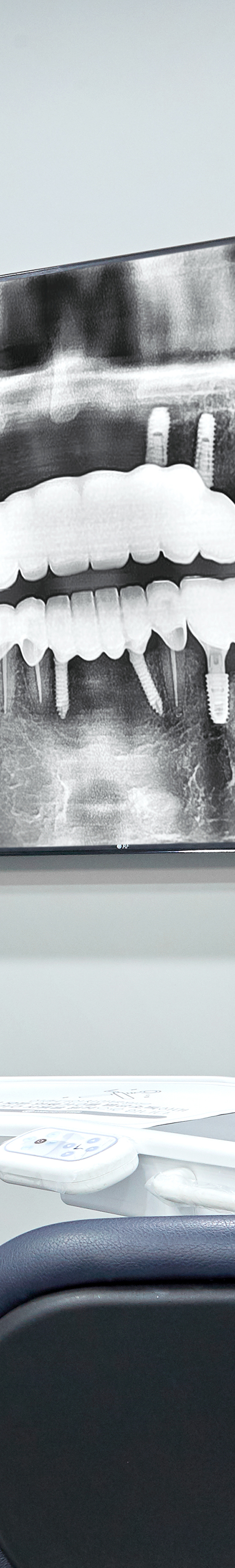 Dangsandong Dental Clinic Implant Care Through a Careful Process image 30