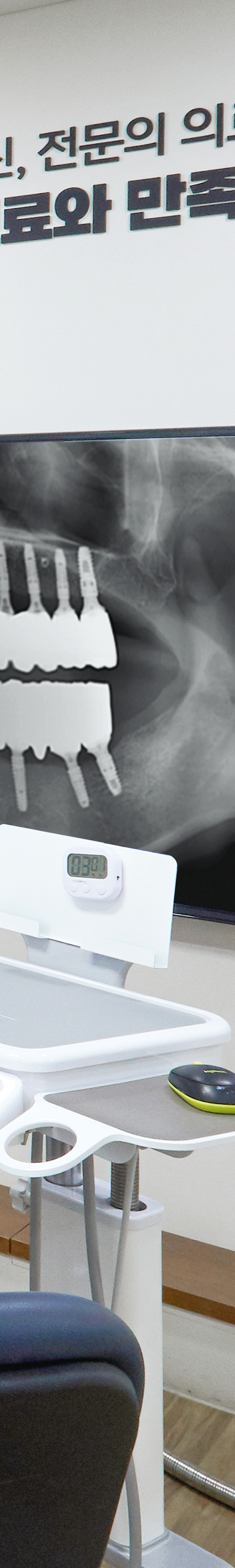 Daesang-dong Dental Clinic Implant Placement: Treatment Through a Careful Process image 41