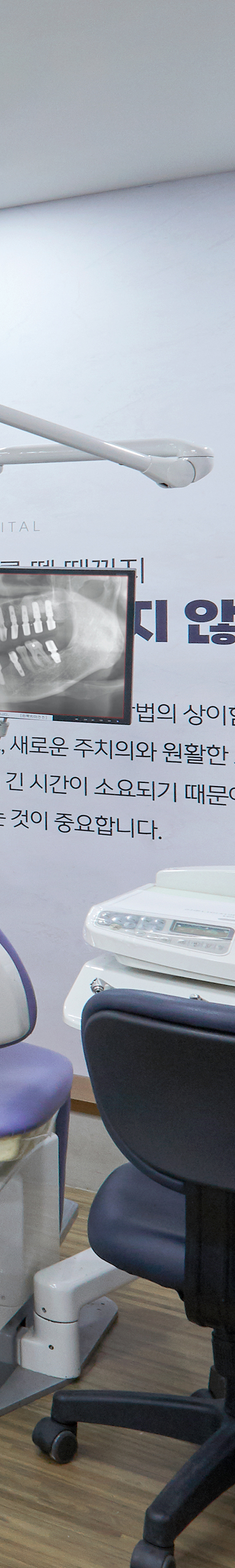 Sinchon Station Dental Clinic Implant Period, Depending on Individual Oral Condition image 40