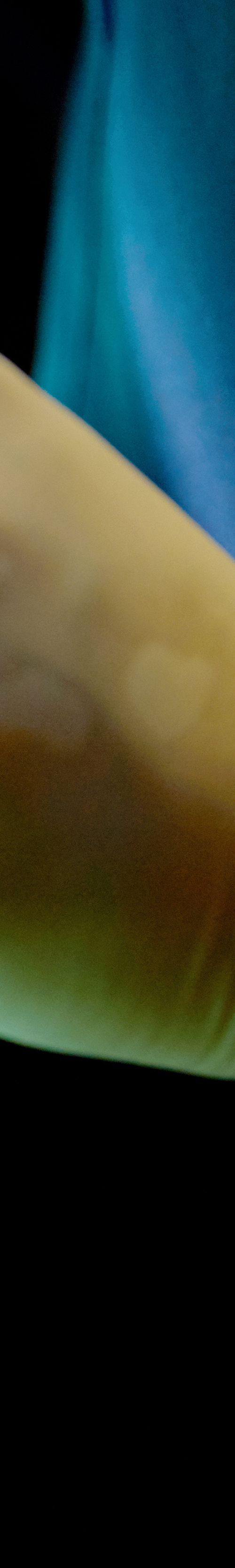 Yeouido Station Dental Clinic - Treatment Through a Precise Implant Placement Process image 32