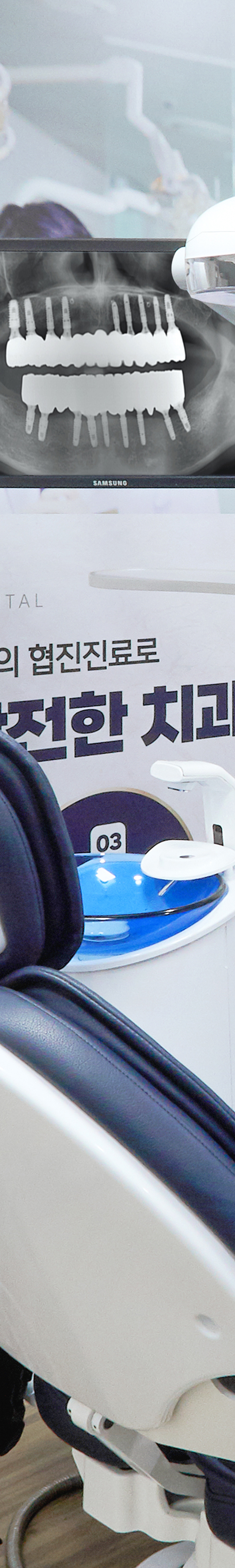 Dangsan Dental Clinic Implant Placement for Long-Term Use image 39