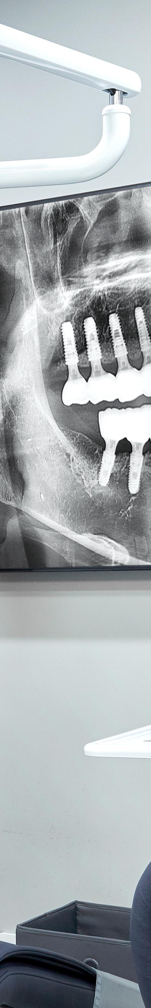 Mangwon-dong Dental Clinic Implant Procedure Based on Extensive Experience image 33
