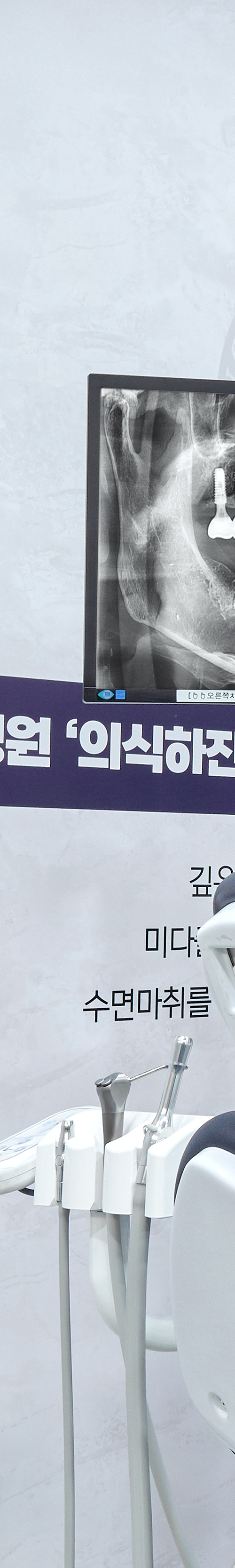 Yangpyeong-dong Dental Clinic: Treatment That Eases Concerns About Implant Procedures image 18