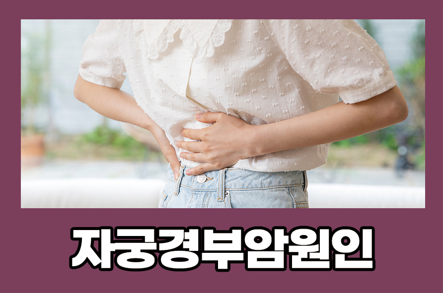 자궁경부암원인 증상과 치료 및 예방법에 대해 관련 이미지 1