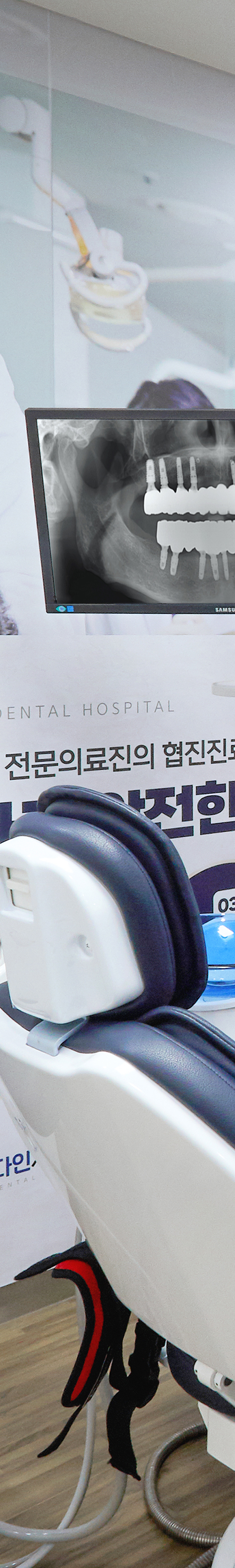 망원동치과 임플란트치료 세심한 계획으로 관련 이미지 30