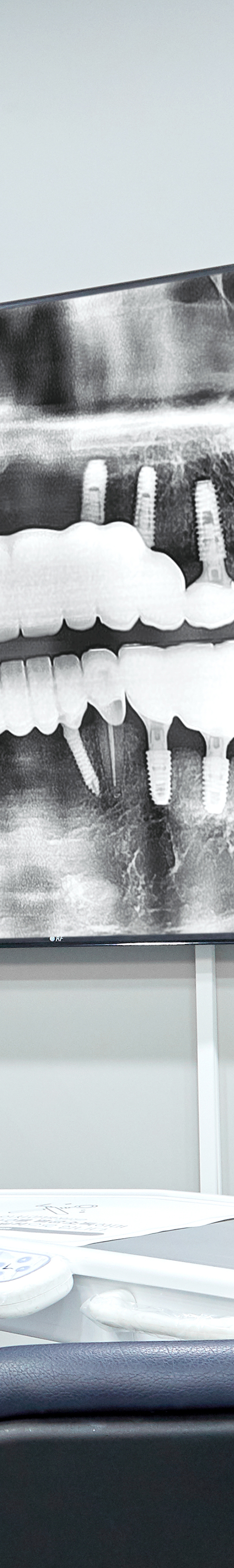 Dangsan Station Dental Clinic: Comfortable Sleep Implant Using Conscious Sedation image 25